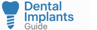 Dental Implants Guide