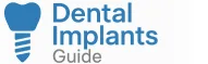 Dental Implants Guide
